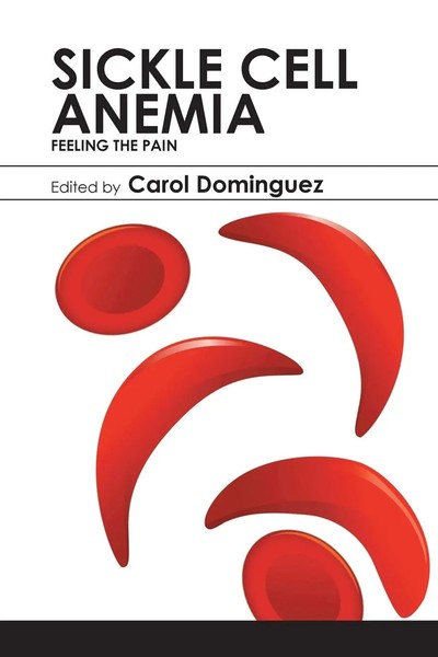Carol Dominguez | Sickle Cell Anemia | Taschenbuch | Englisch (2017) | Xlibris-image