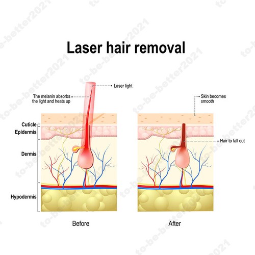 Laser 3in1 ND YAG OPT Pigment Hair Tattoo Removal Machine IPL Skin Rejuvenation - Picture 5 of 18
