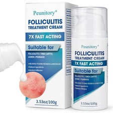 Folliculitis Treatment Cream - 5 Benzoyl Peroxide Treatment for Scalp, Body  B