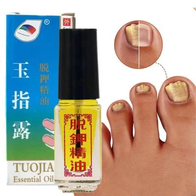 Nail Treatment Fungus Anti Fungal Toe Removal-Care Liquid Solution P0M9 - image 1 of 4