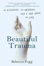 Beautiful Trauma: An Explosion, an Obsession, and a New Lease on Life by Fogg
