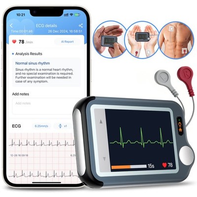 Home EKG Monitor with External Cable, 30s/60s/5min Recording + AI ECG Analysis