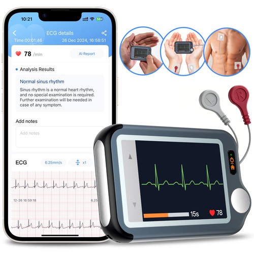 Home EKG Monitor with External Cable, 30s/60s/5min Recording + AI ECG…