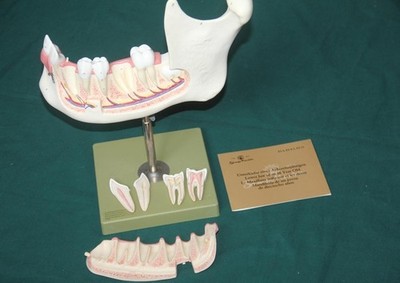 Somso-Plast  ES4 Unterkiefer eines Achtzehnjährigen Lower Jaw of an 18Year Old