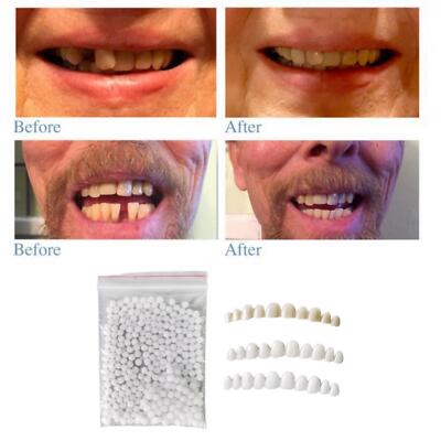 Wiederverwendbare Zahnprothese Veneers mit passenden Perlen temporäre falsche falsche Zähne