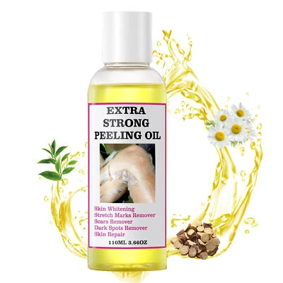 Extra Strong Peeling Oil Strong Peeling Solution Extra Strength 110ml Very Well