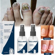 Blinzador Nails Spray Fingernails Nutrition Long-Lasting Toenail Care Supplies
