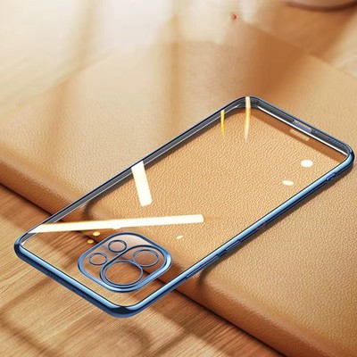 Luxury Plating Case für Xiaomi Mi 11 Lite 5G NE 11T Pro 11i 12 10 Soft Cover