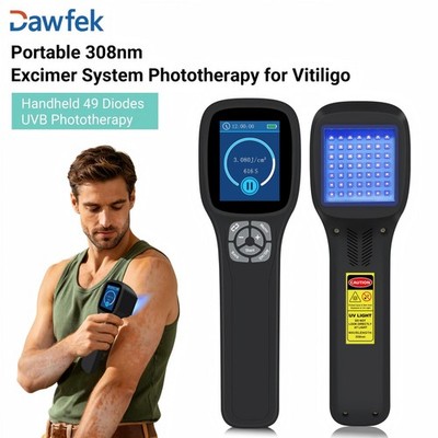 49 Diode 308nm Excimer UVB Light Portable Handheld with MED Mode for Skin Issues
