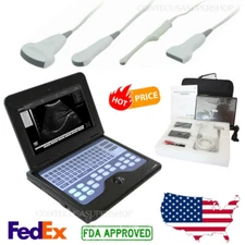 CMS600P2 B-ultrasound scanner,convex/linear/cardiac/endo-vaginal probe