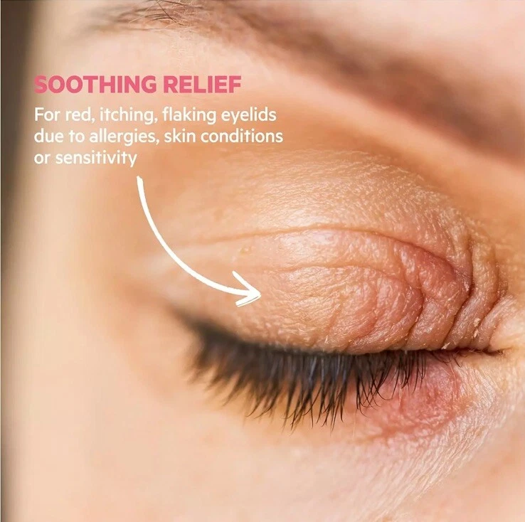 3x SVR Palpebral Creme Topialyse 15ml Irritated Eyelids Anti-Itching Cream 05/24 - Image 4 of 4