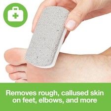 12 PACK Marianna Foot Pumice Stone for Feet Hard Skin Callus Remover, Scrubber
