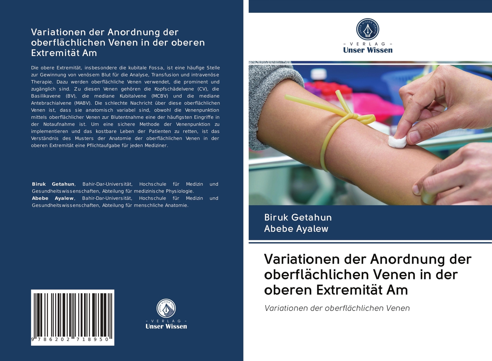 Variationen Der Anordnung Der Oberflächlichen Venen In Der Oberen