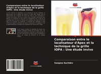 Swapna Sachdev | Comparaison Entre Le Localisateur D'apex Et La Technique De...