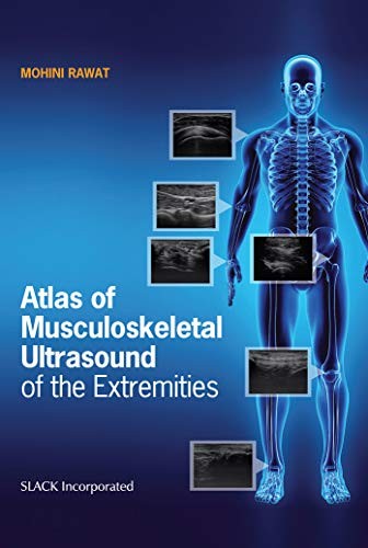 Atlas of Musculoskeletal Ultrasound of the Extremities.by (author) New<|