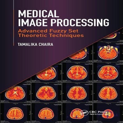 Medical Image Processing Advanced Fuzzy Set Theoretic Techniques