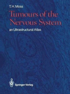 Timothy H. Moss Moss, Timothy Tumours of the Nervous Sys (Paperback) (UK IMPORT)