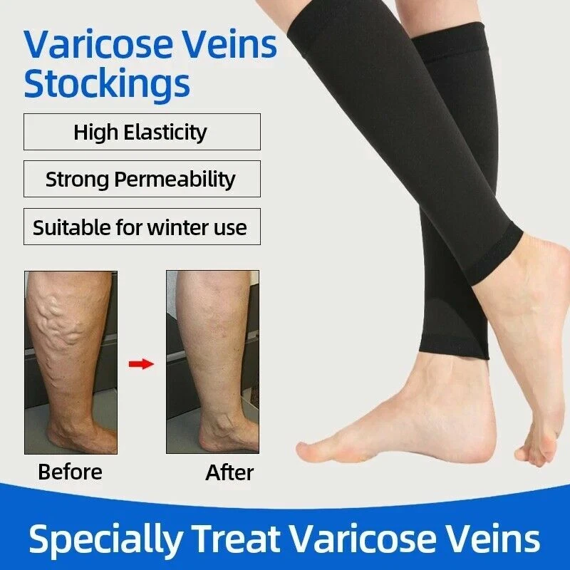 Prevent Calf Varicose Veins Compression Sock Medical Grade One Pressure  Treat A+