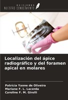 LocalizacióN Del áPice RadiográFico Y Del Foramen Apical En Molares Mariane F. L