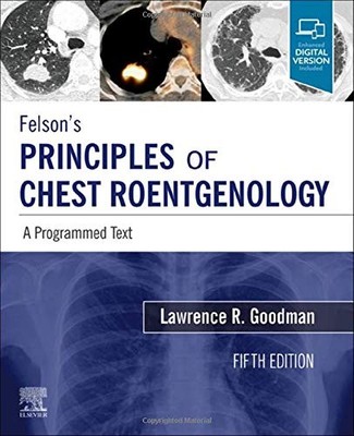 Felson's Principles of Chest Roentgenology  by Lawrence Goodman FAAC