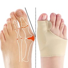 1 Pair Bunion Corrector Toe Separator Hallux Valgus Relieve the Pain Of Big Toe