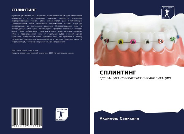 Akhilesh Sankhqqn | Splinting | Taschenbuch | Russisch (2021) | Sciencia Scripts-image