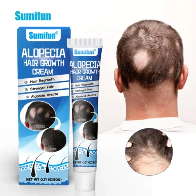 SUMIFUN 20g New Alopecia Treatment Cream Hair Growing Prevent Alopecia Baldness Regrowth