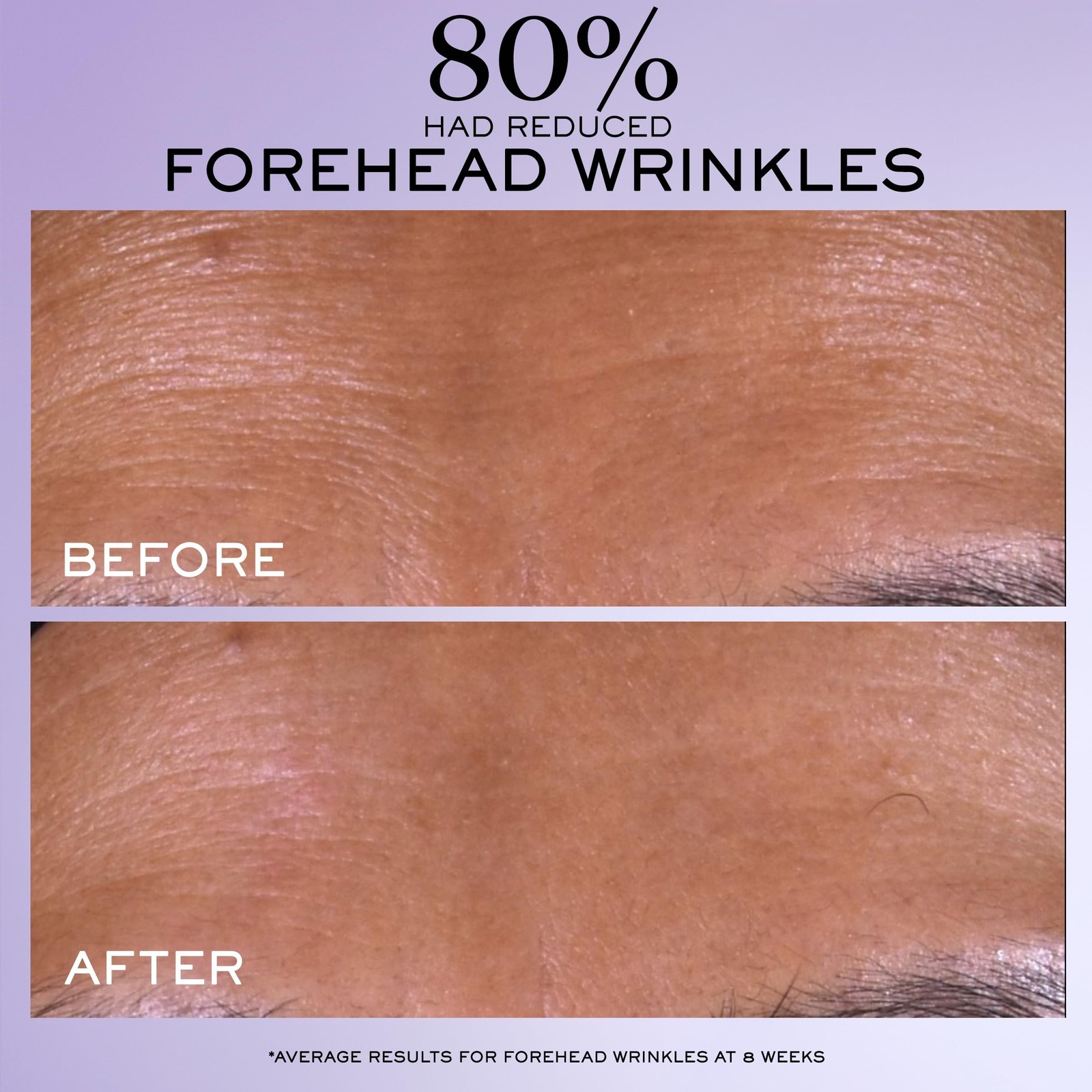 Lancôme Rénergie C.R.x. Triple Serum Retinol - Anti-Aging Serum With P