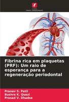 Fibrina Rica Em Plaquetas (Prf): Um Raio De EsperançA Para A RegeneraçãO...