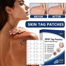 432Pcs Skin Tag Remover Patches Quick Effective Mole Wart Removal Pad Sticker