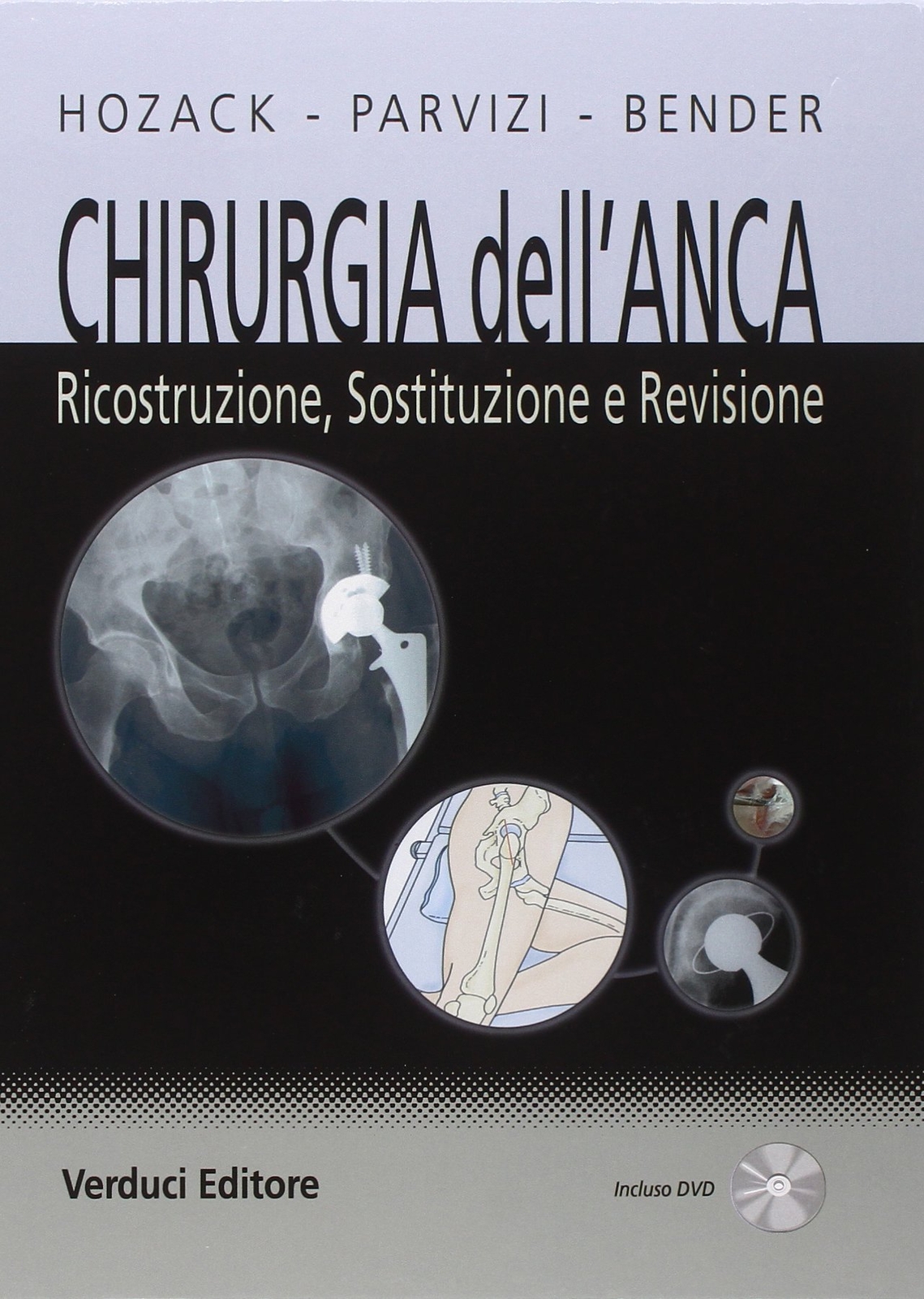 9788876208423 Chirurgia dell'anca. Ricostruzione, sostituzione e.... Con DVD-ROM