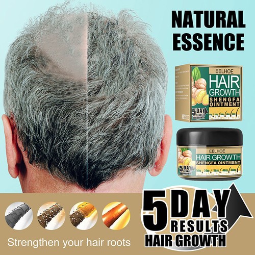 Natural Ginger Hair Growth Cream Men&Women Germinal Hair Loss Treatment Cream | eBay Natural Ginger Hair Growth Cream Men&Women Germinal Hair Loss Treatment Cream | eBay