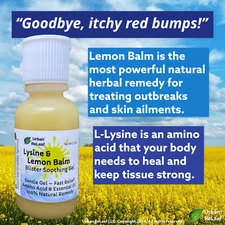 Urban ReLeaf Lysine Lemon Balm Blister Soothing Gel! Cold Sore Shingles Pox Itch