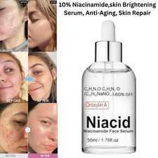 Niacid 10 Niacinamide Face Serum for removes dark spots acne for all skin 50ml