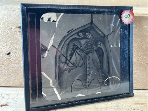 Antique (19) Medical GLASS SLIDES, PLASTIC SURGERY With Wood Carrying Case 1930s - Picture 9 of 23