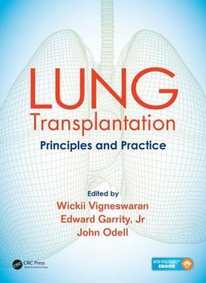 Lung Transplantation: Principles and Practice, , Good Book