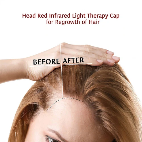Hair Loss LED Red and Blue Near Infrared Light Therapy Cap Hat for Hair Regrowth - Picture 10 of 12