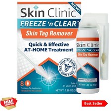 Skin Tag Remover - Cryogenic Kit with 8 Precision-Tip Applicators  Tweezers ...