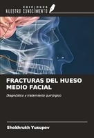 Fracturas DEL Hueso Medio Facial Shokhrukh Yusupov