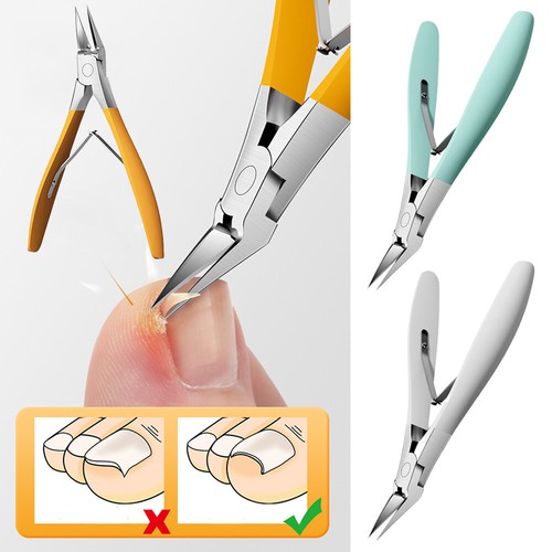 Alicate de uñas de acero inoxidable encarnado cortador de uñas removedor de piel muerta herramienta de pedicura - Imagen 2 de 26