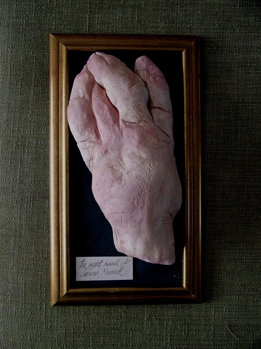 Joseph Merrick Death Mask