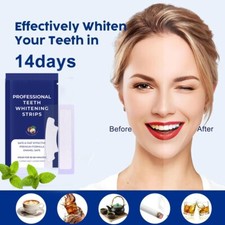 14 Pairs Professional Teeth Whitening Strips Rapid Bleaching Remove Stains Smile