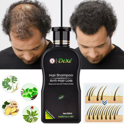 Dexe Hair Growth Shampoo Thickening & Regrowth Formula, Anti Hair Loss Treatment