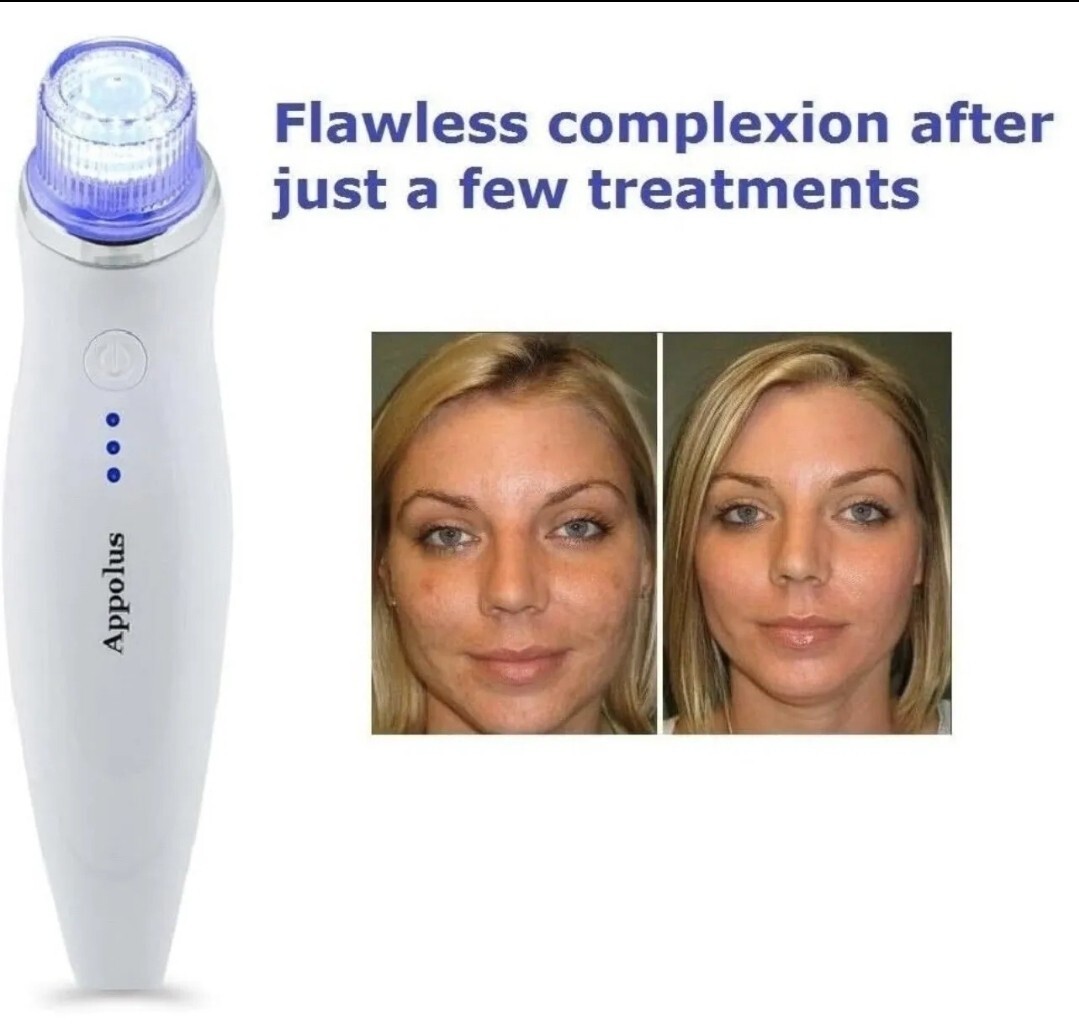 APPOLUS Professional Microderm Device. Diamond Microdermabrasion Facial