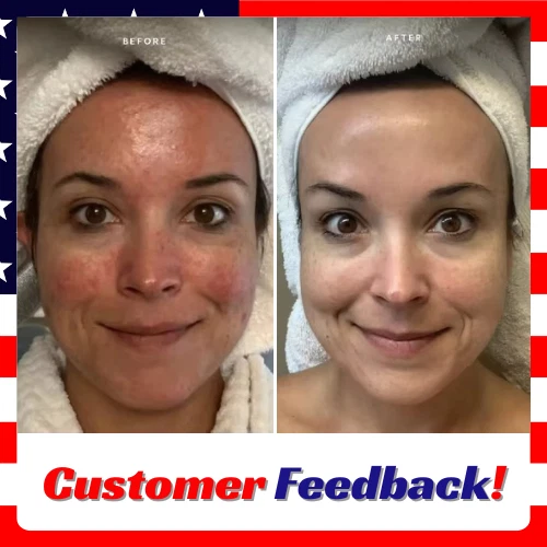 Gel esfoliante Orange Enzymes, gel esfoliante orgânico para rosto e corpo - Imagem 2 de 4