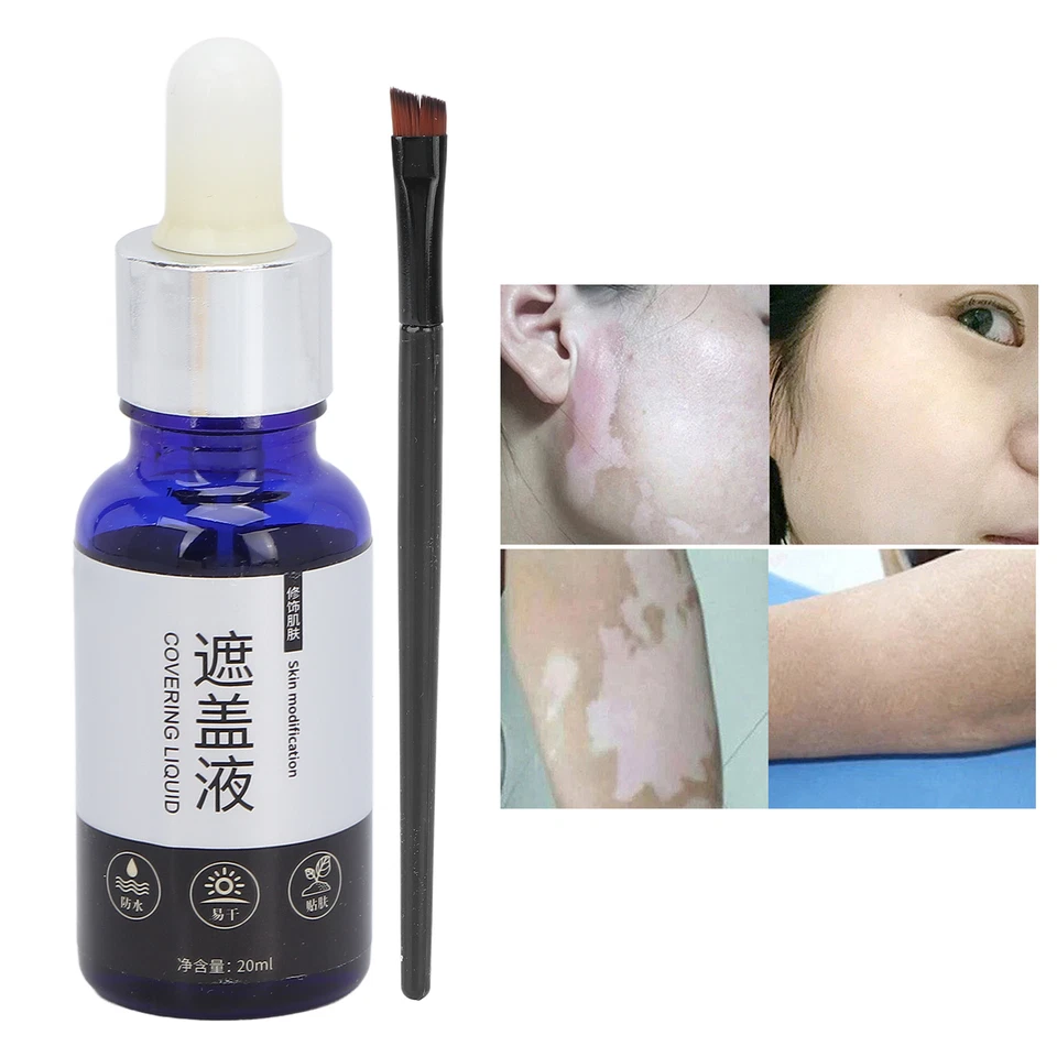 Vitiligo Covering Liquid Waterproof Makeup Vitiligo Concealer Cosmetics 20ml - Image 2 of 4