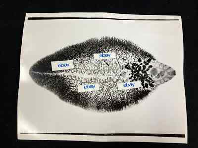 VINTAGE HUMAN PARASITOLOGY 11X14 ORIGINAL B&W PHOTO, FASCIOLA HEPATICA
