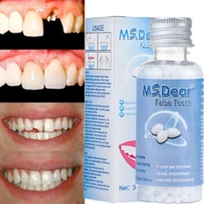 Tooth Repair Granules Temporary Kit Fitting Beads Reusable Moldable False Teeth.