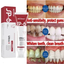 2025 Whitening Teeth Probiotics Breath Removing Toothpaste SP-6 Refreshing Teeth