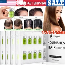 8-40Pcs MICRONEEDLE Hair Regrowth System, Advanced Hair Treatment Ginseng Serum